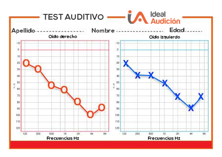 Evaluación auditiva para medir la audición