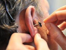 Adaptación de audífonos por el audioprotesista